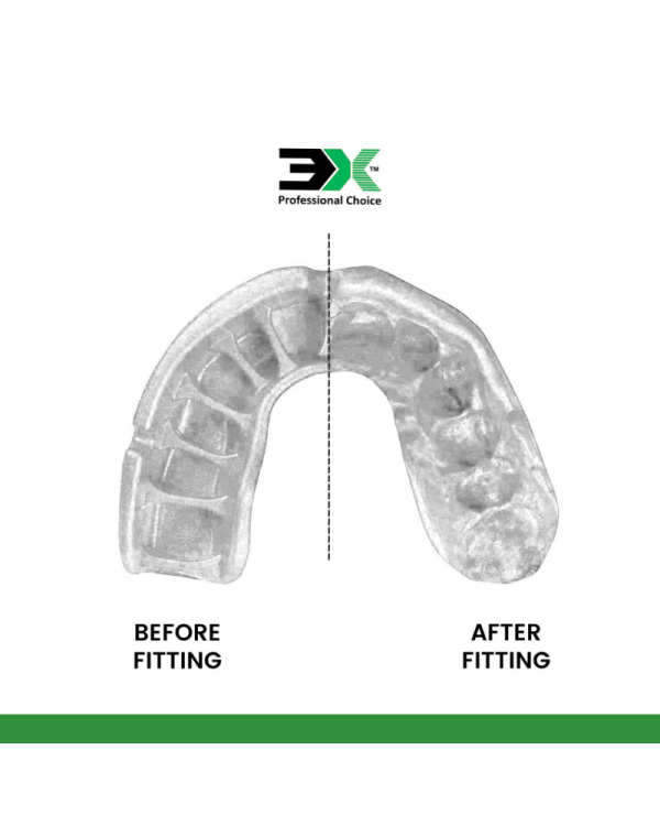 3X Sports Mouth Guard – Gum Shield for Boxing