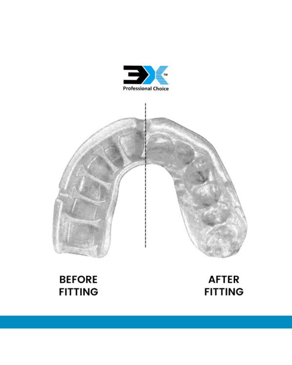 3X Sports Mouth Guard – Gum Shield for Boxing