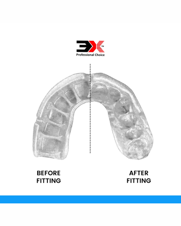 3X Sports Mouth Guard – Gum Shield for Boxing
